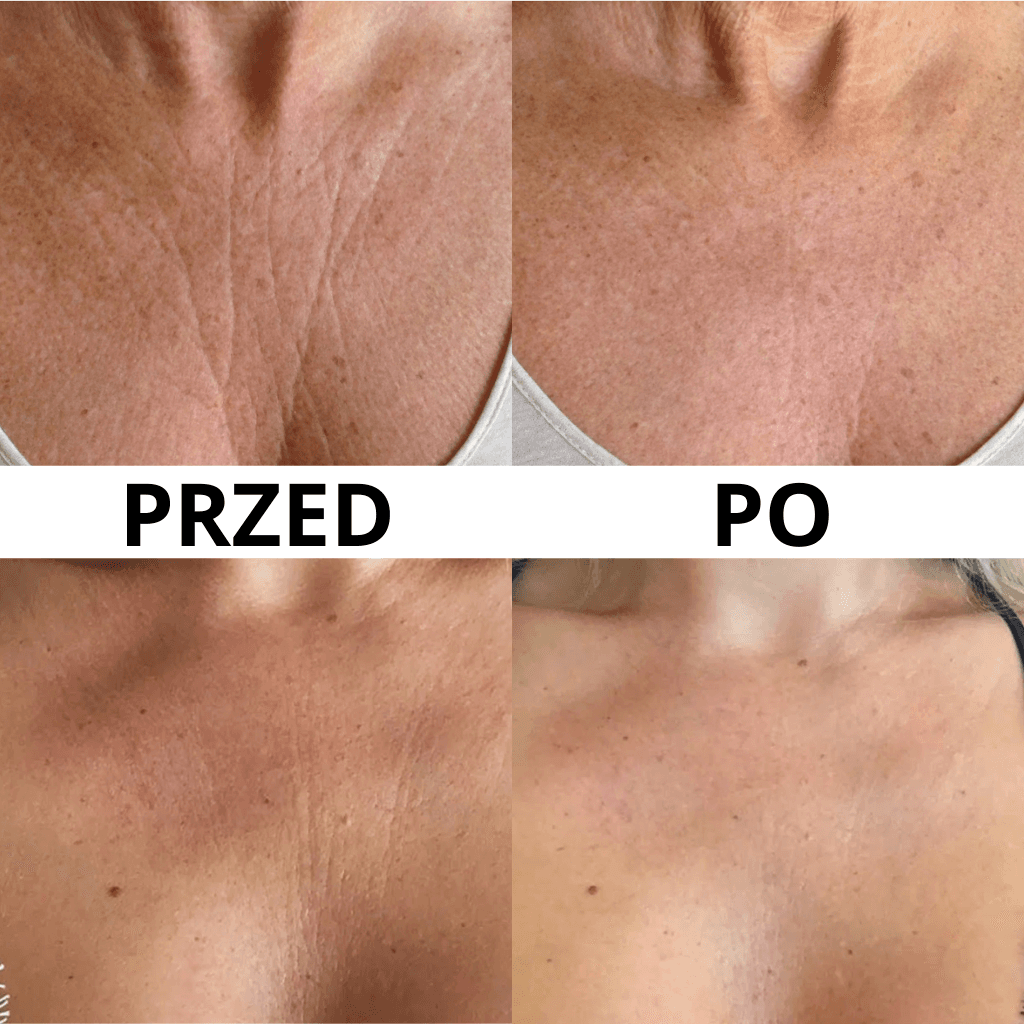 SmoothUp - Wielorazowy Silikonowy Plaster na Biust i Dekolt